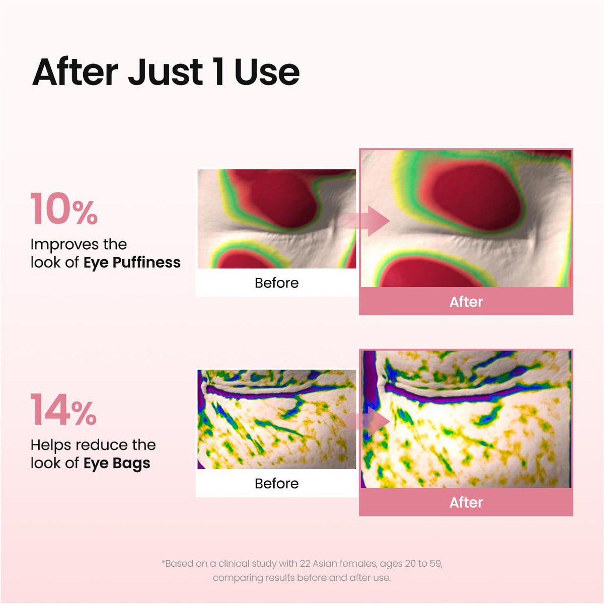 Youthful Radiance Eye Patches