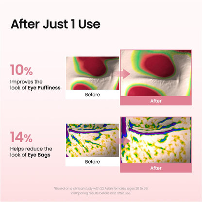 Youthful Radiance Eye Patches