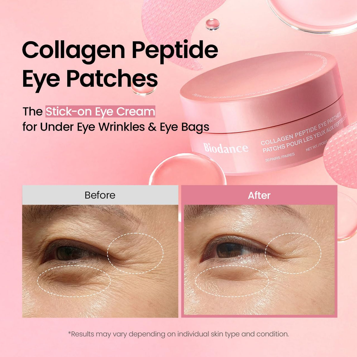 Youthful Radiance Eye Patches